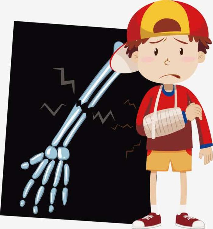 突发骨折的急救常识