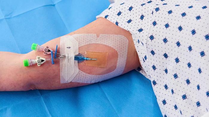 化疗丨picc置管为你化疗之路保驾护航