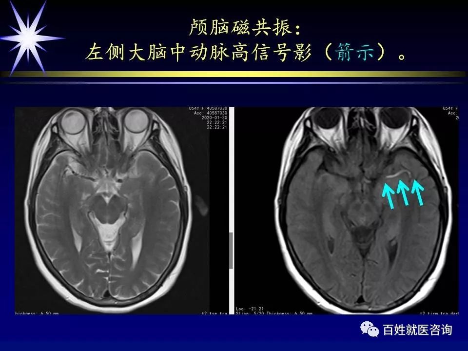 磁共振要脱内衣吗_内衣美女(3)