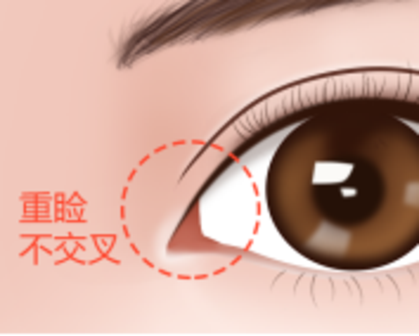 教你一招 四大眼型特征一眼识别 你的眼睛暗藏哪些风格 健康号 微医