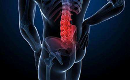 腰椎间盘突出钙化是怎么回事?