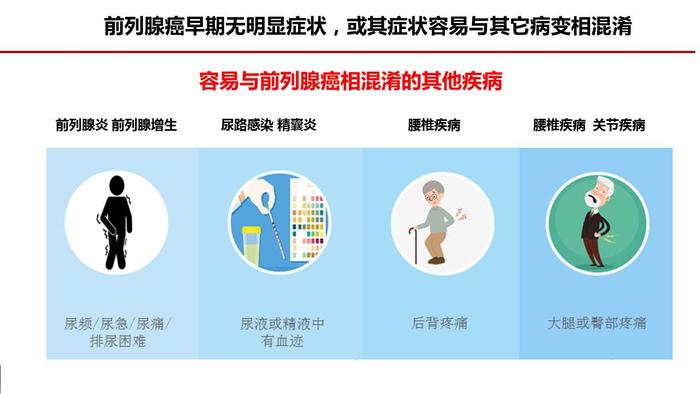 前列腺癌有什么临床表现