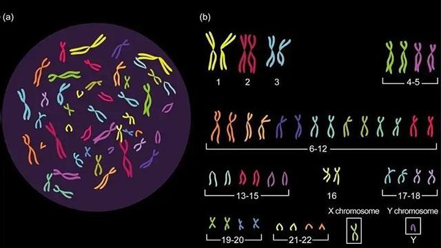 人体染色体组型图片
