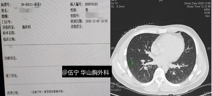 周一成.jpg