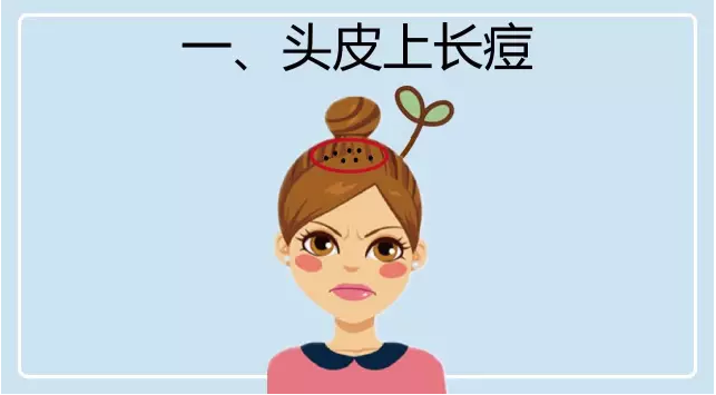 长痘位置能看出啥?反正不是内脏健康 - 微医(挂号网)