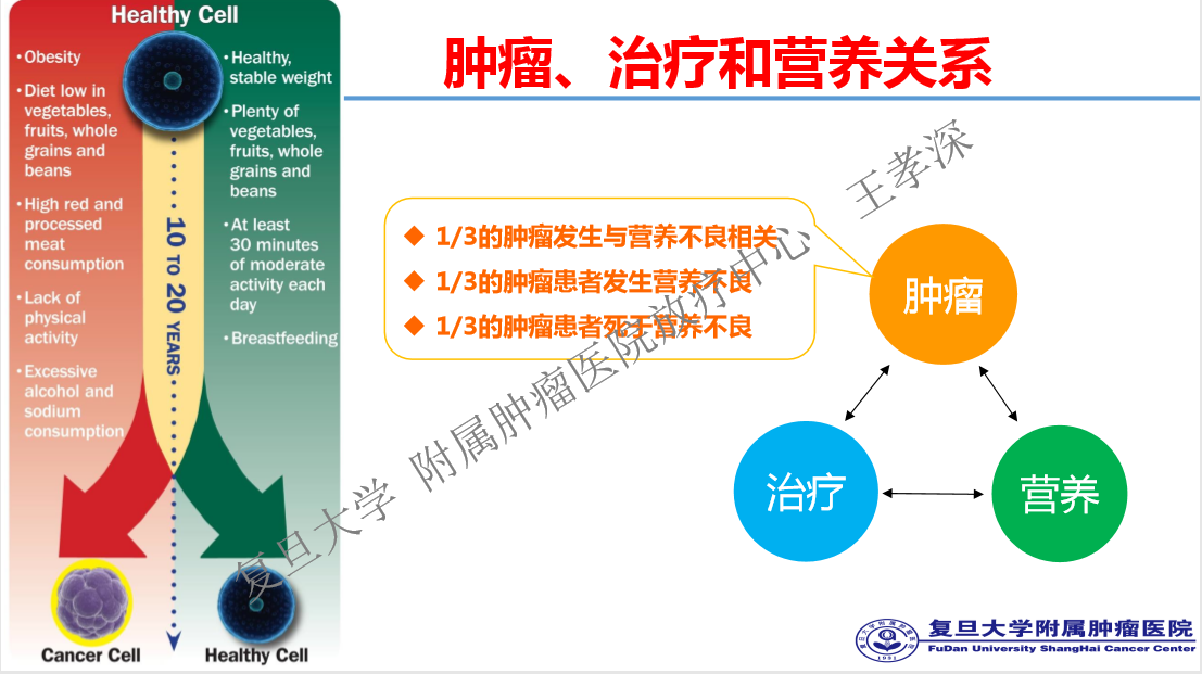 头颈部肿瘤营养支持有哪些注意事项