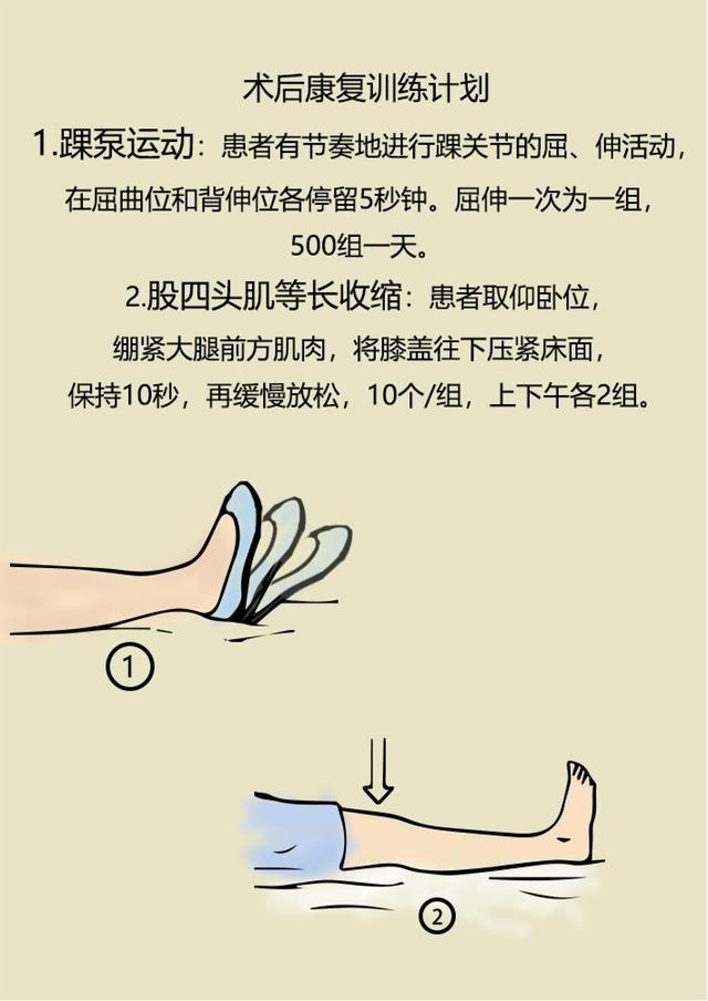 髋关节置换术后康复锻炼和注意事项漫画版