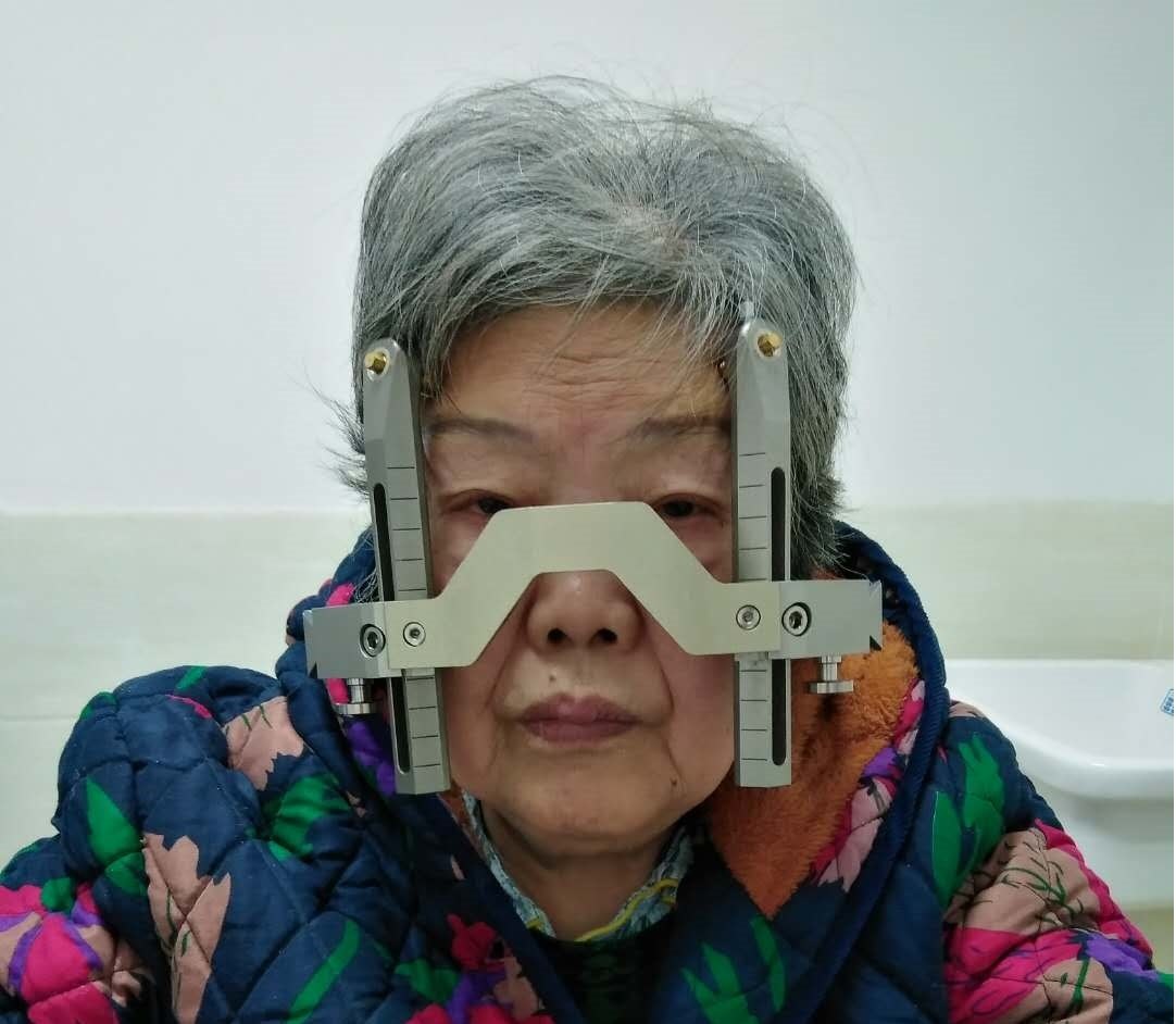 高龄三叉神经痛患者怎么治伽玛刀r刀治疗