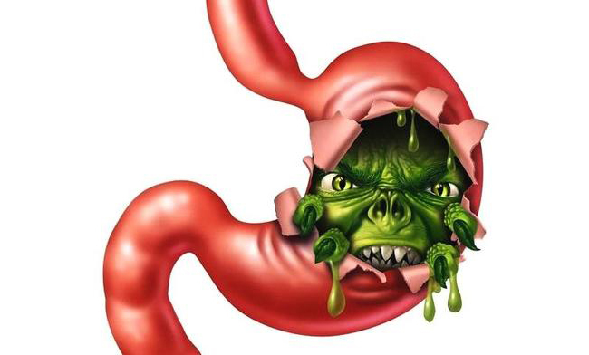 胃酸反流性咽喉损伤