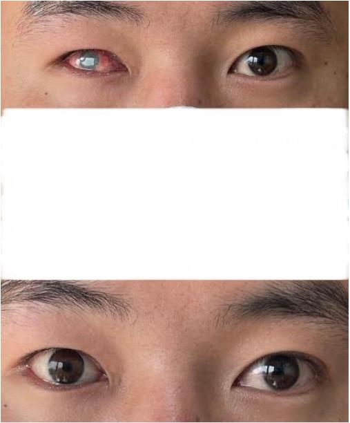 义眼系列之二眼见为实义眼的效果和他们的故事