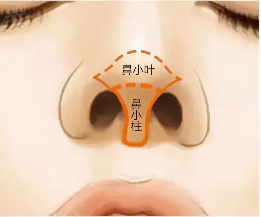 想要自然美鼻,要重视鼻小柱与鼻小叶这两个部位