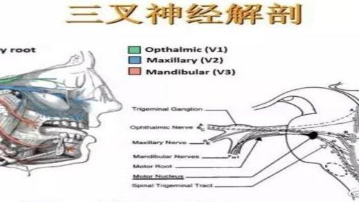 三叉神经痛会不会不治自愈