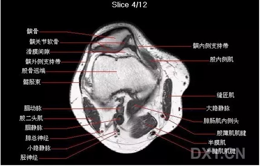 【关节影像】膝关节的磁共振(mri)解剖表现