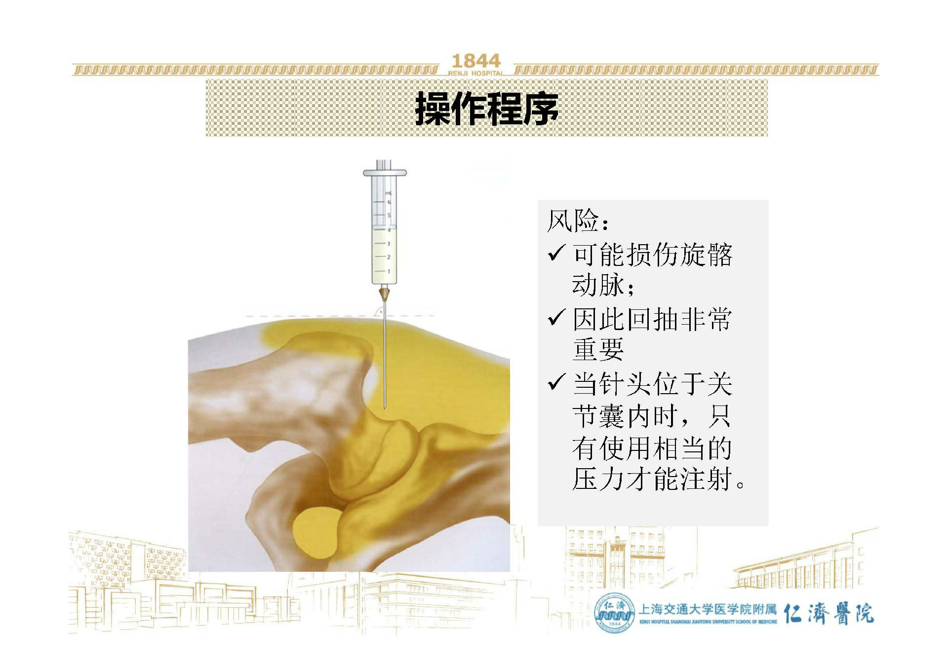 髋关节注射治疗