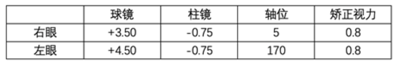 如何看懂验光报告 健康号 微医