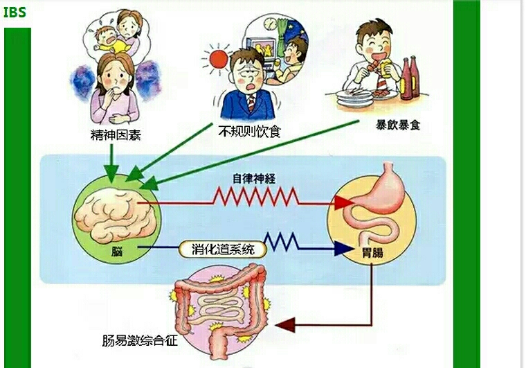 腸易激綜合徵的預防與保養!