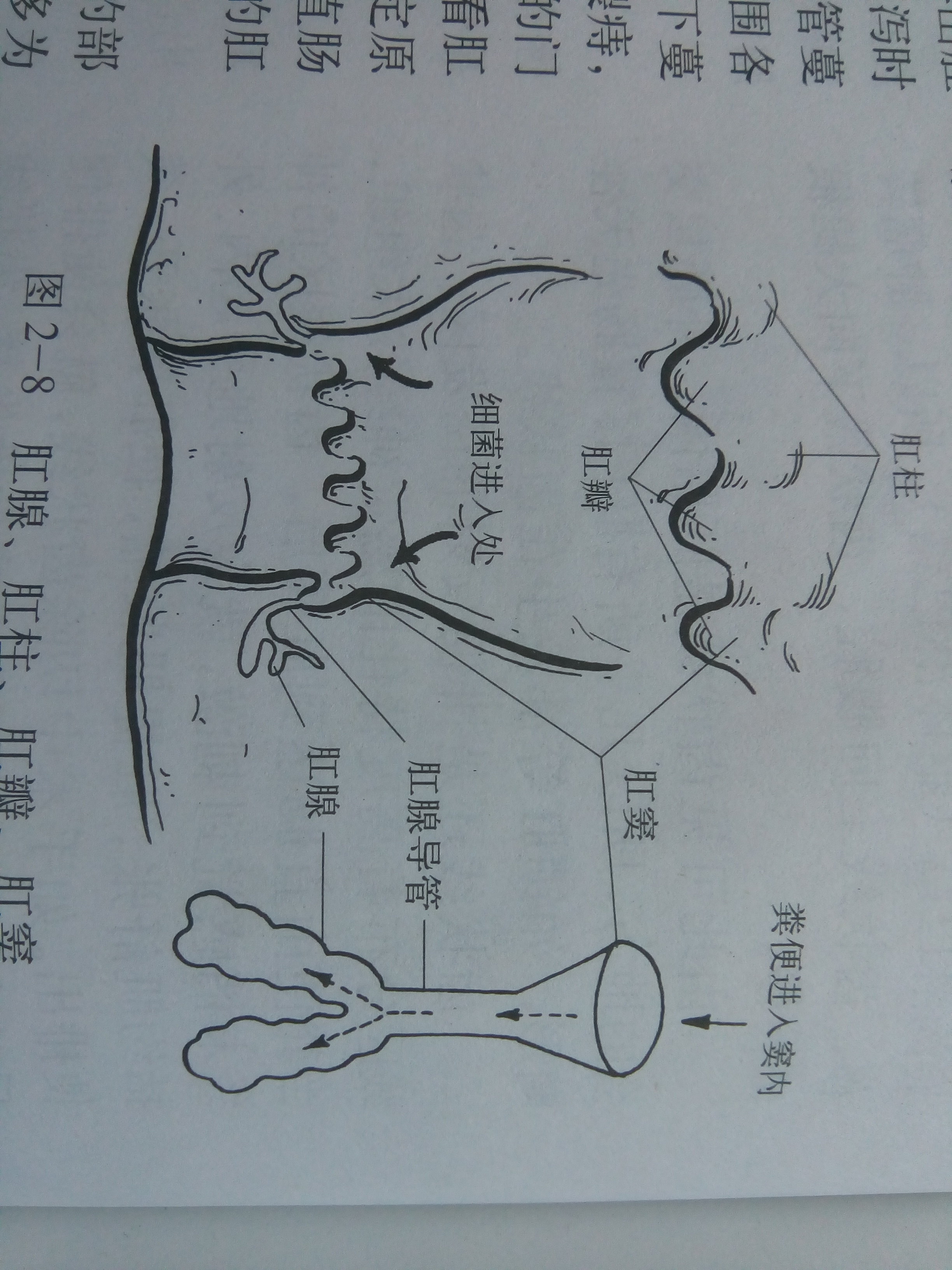 其次,95%的肛周脓肿的罪魁祸首竟然是肛腺感染.