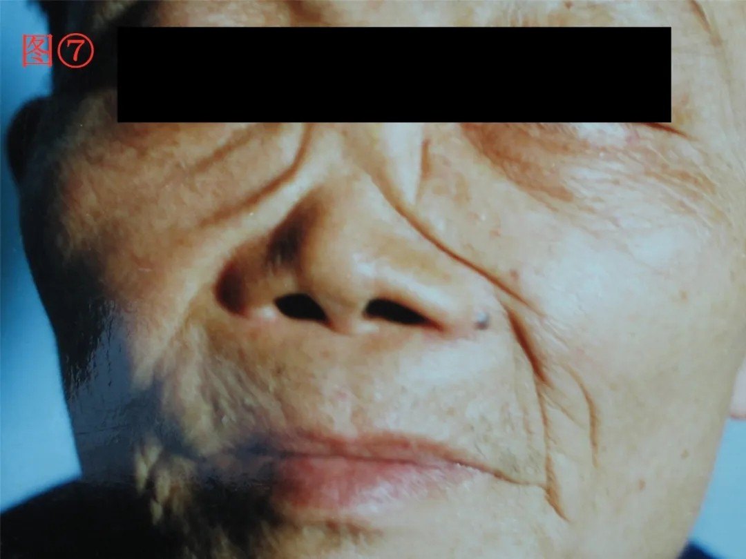 难言之隐系列之---梅毒 - 微医(挂号网)