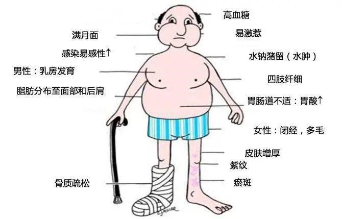 新生儿蛙腹图片