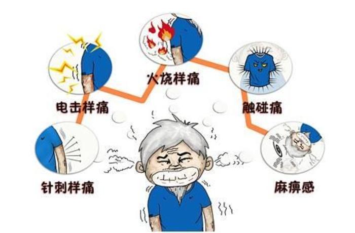 得了三叉神经痛怎么根治