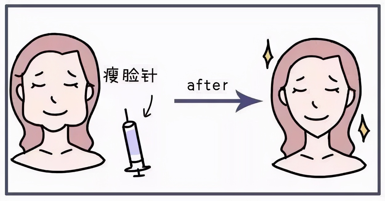 注射瘦脸针如何达到理想效果