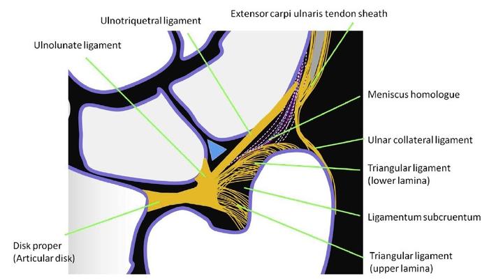 (原创)腕关节疼痛的小朋友要注意排查三角纤维软骨复