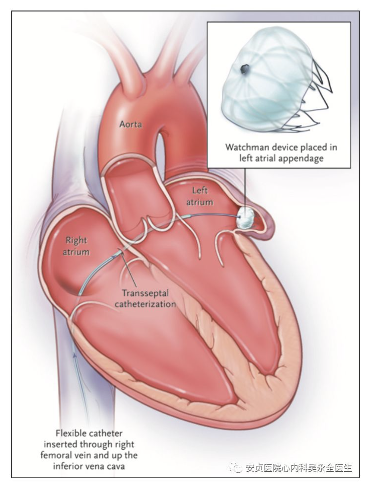 房颤只是心房的异常收缩么