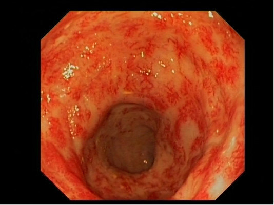 直肠位于消化道末端,是一个肌肉管道,上接乙状结肠末端.