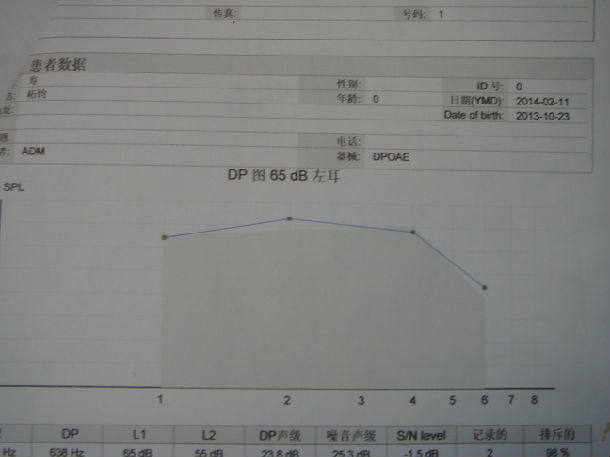 图3  治疗7月后左耳dpoae正常图4  治疗7月后右耳dpoae正常