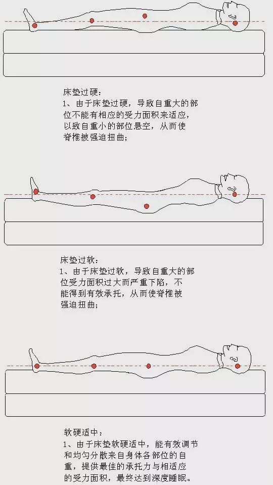 爱护脊椎从睡眠做起