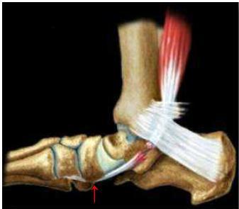 足的副舟骨是什么梗看完这篇文章就全明白了