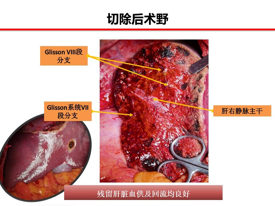 宫颈癌的哪8种症状表现出来_癌宫颈癌什么症状_癌宫颈有哪些症状