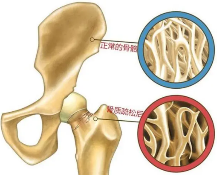 gvn313203230?resize=700:x