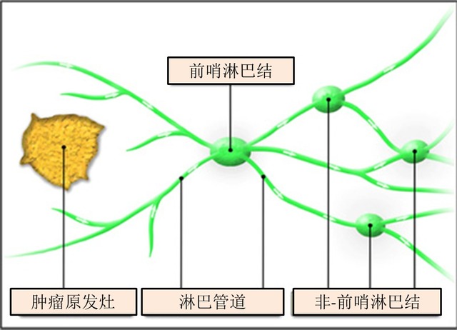前哨淋巴结你应该知道的那些事儿