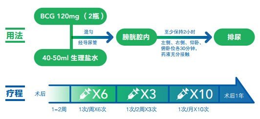 膀胱癌术后灌注卡介苗是必须的吗?