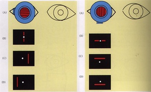 此主题相关图片如下:检查者将马氏杆横置于右眼前,分别让病人注视33cm