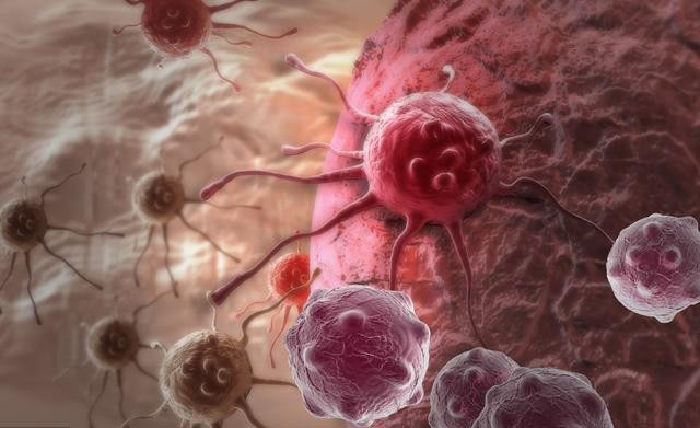最难治的十种肿瘤图片