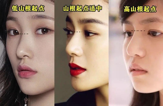 美鼻常见误区高山根鼻子好看
