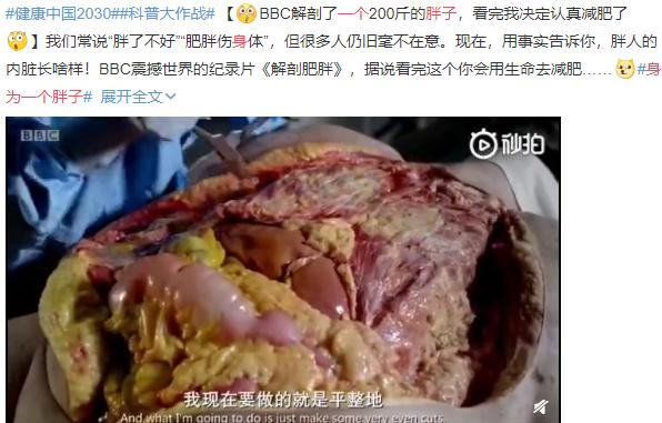 肉眼可见的大量的黄色脂肪堆积在皮下,塞满了腹腔还有各种内脏的周围