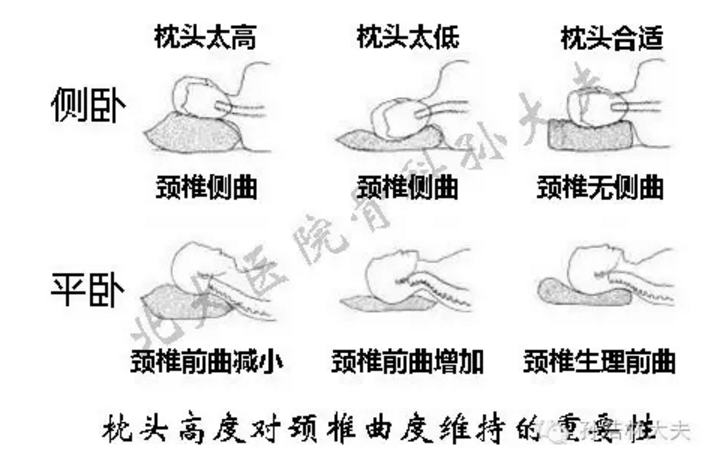 常见问答五颈椎生理曲度变直怎么办