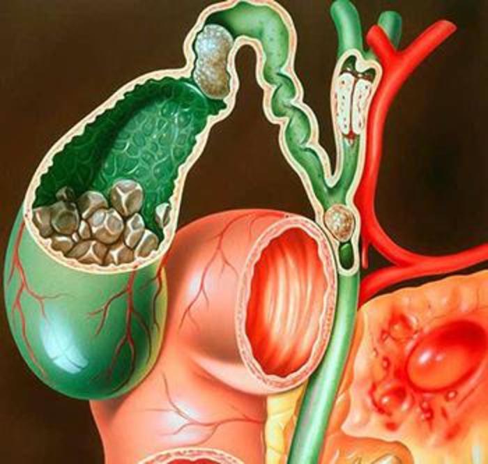 iFS47937554?resize=700:x