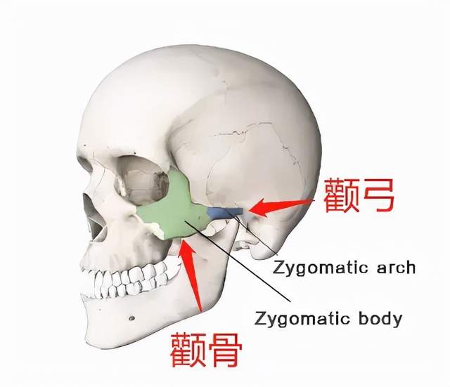 韦敏科普丨面中部宽大到底是颧骨问题还是颧弓问题