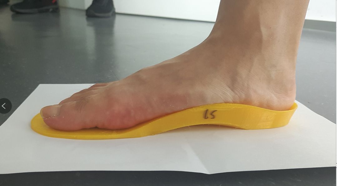 支撑足弓实现足部三点支撑,矫正跟骨内外翻,平衡足底压力,预防矫正