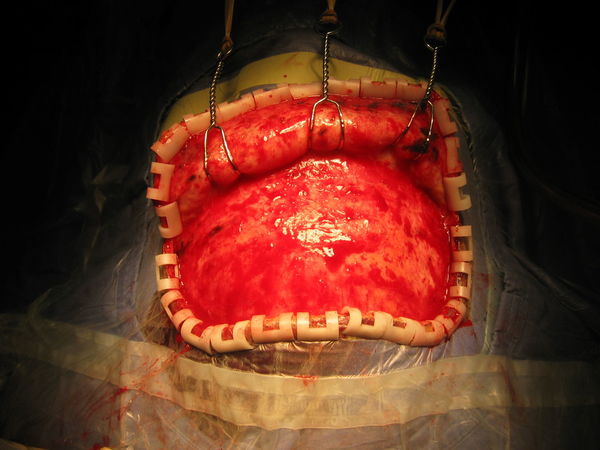 开颅手术不可怕 - 微医(挂号网)