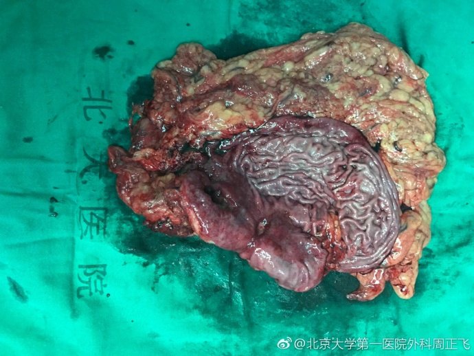 安徽省立醫院代掛專家號，減少患者等待就醫的時間的簡單介紹