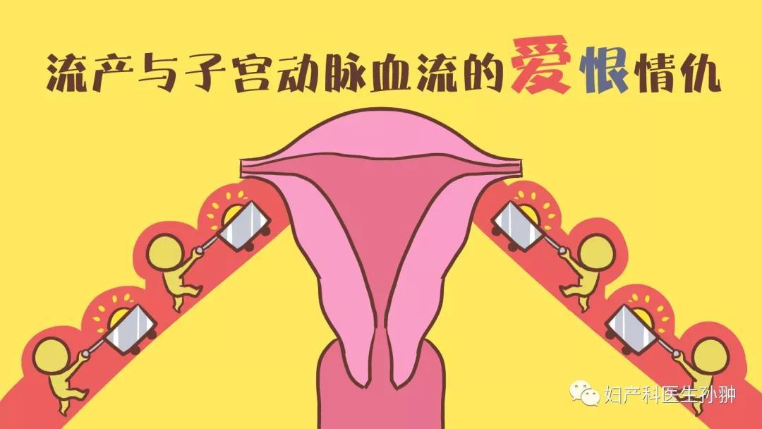 流产与子宫动脉血流的爱恨情仇