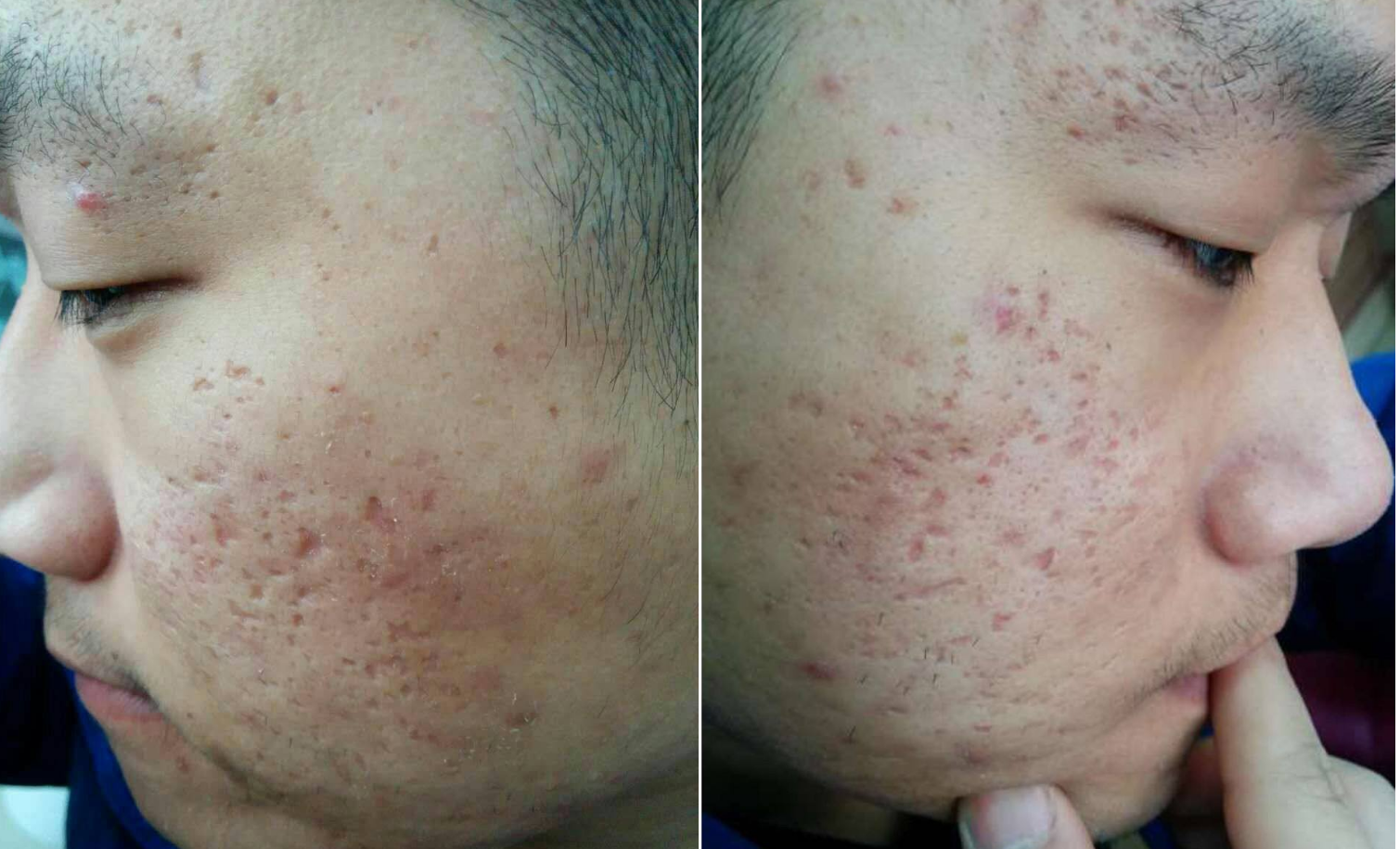 怎样才能告别"月球表面"?