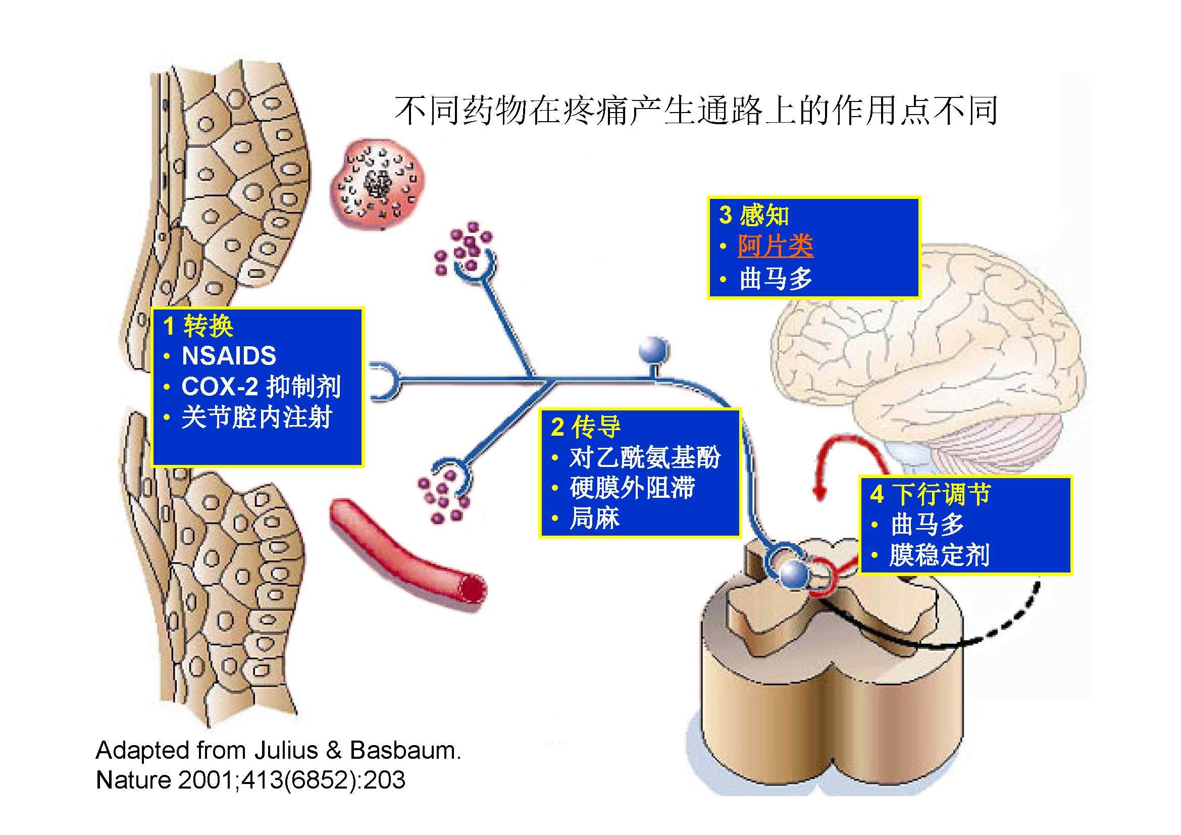 急性疼痛及药物治疗