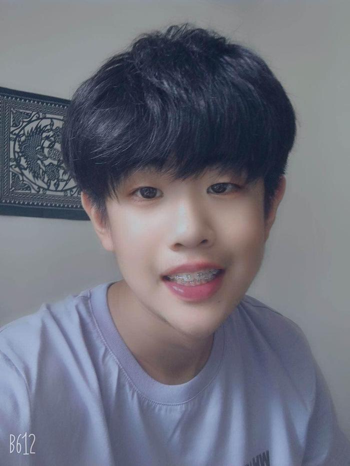 16岁小帅哥牙齿矫正五个月变化分享