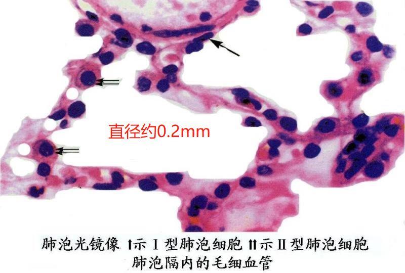 2毫米的微观世界:肺泡.磨玻璃结节的发生也是从这里开始.
